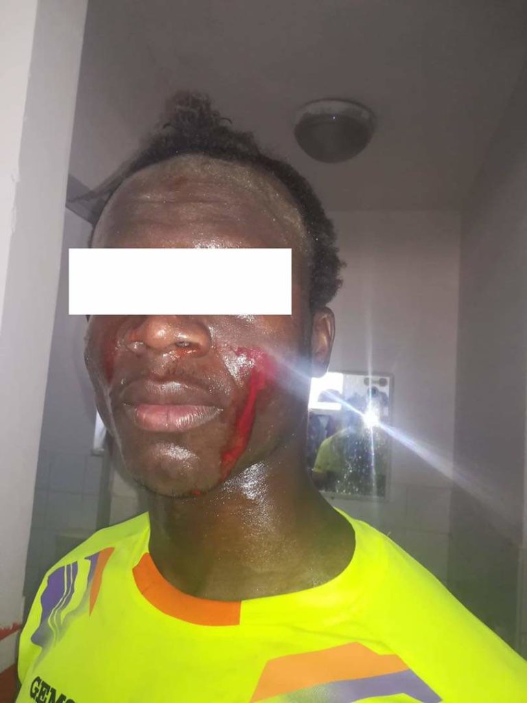 Calcio e razzismo in Prima categoria