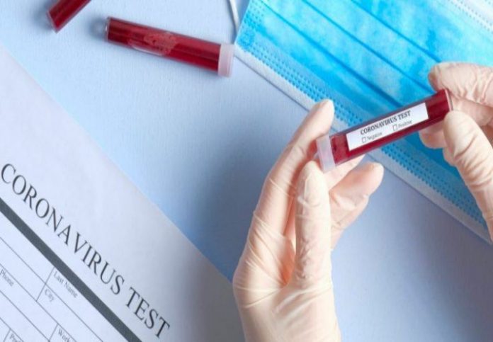 Coronavirus--positivo-rogliano