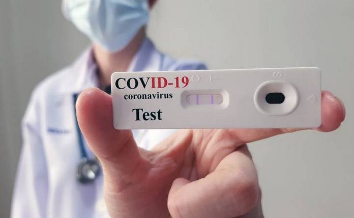 test-sierologico-covid-19-coronavirus-asp-cosenza-118