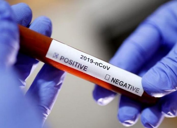 Coronavirus, un caso positivo anche a Rizziconi