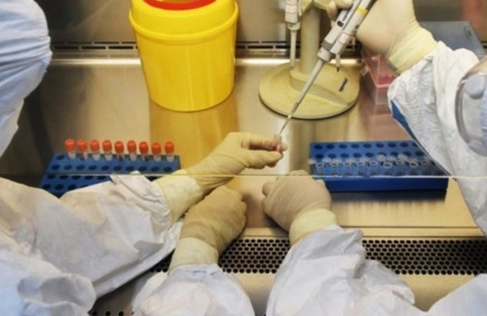 presunti casi covid-19 Curinga