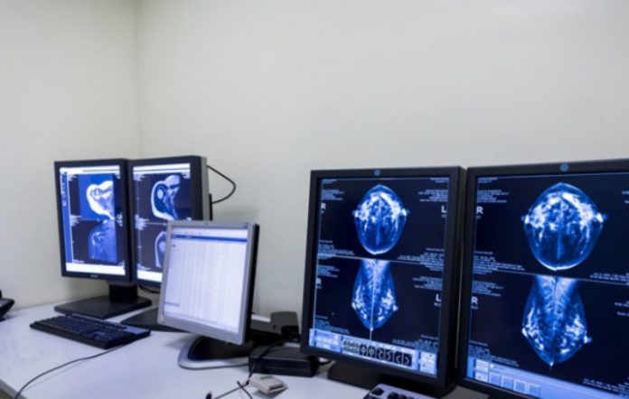 stop al servizio di radiologia a cassano ionio