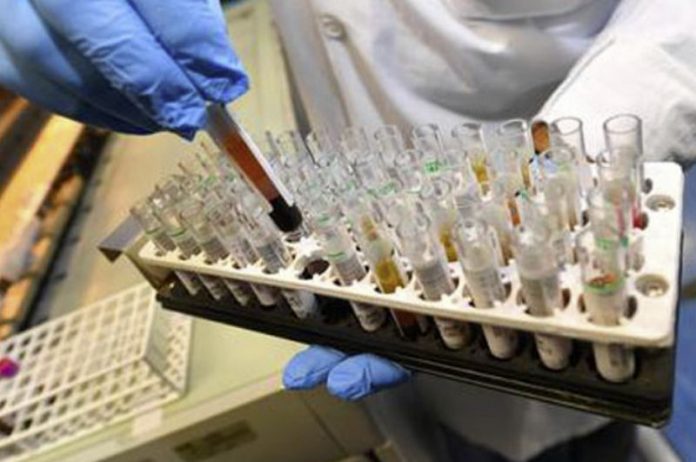 aumentano i casi nel vibonese