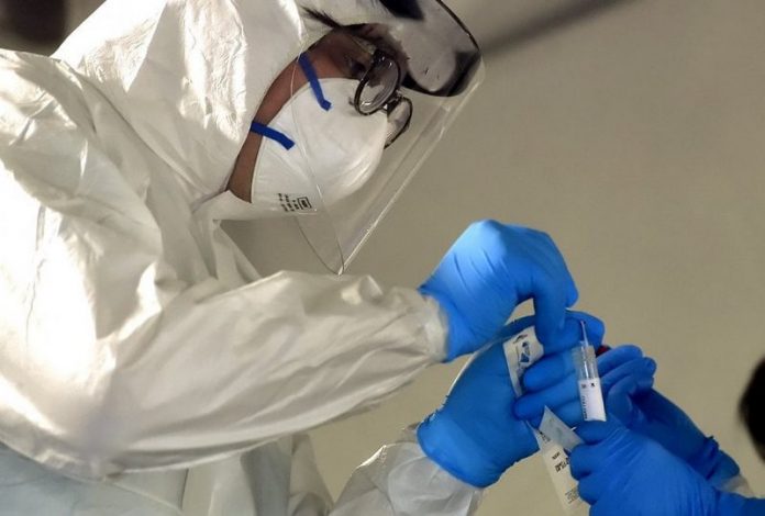 tamponi coronavirus covid