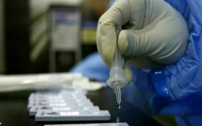 coronavirus introdurre test nuovi perdiversamente abili