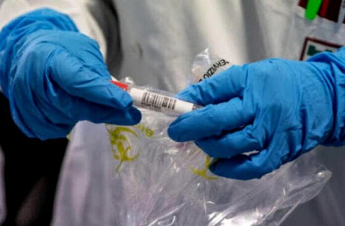 revoca zona rossa torre di ruggiero