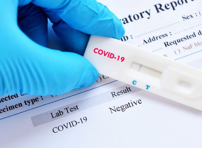 test rapidi coronavirus