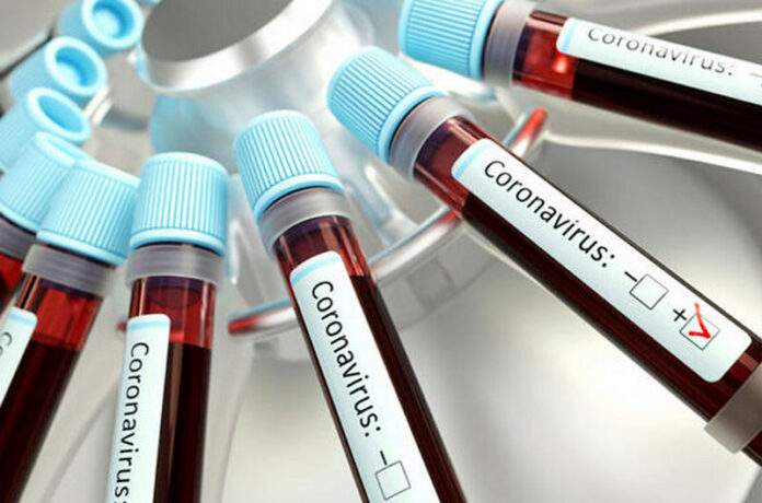 Coronavirus provette