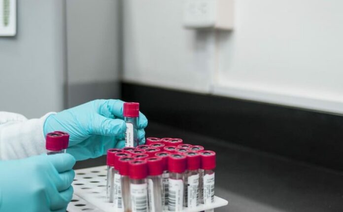 ritardo esiti tamponi