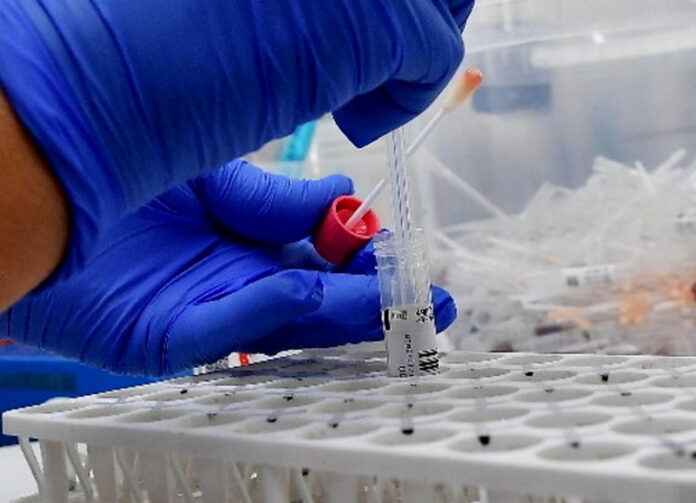 test rapido varinti covid