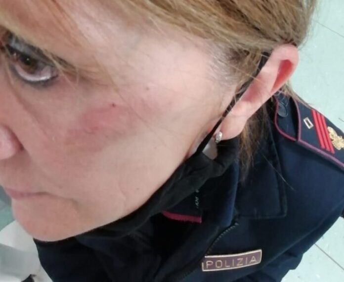 poliziotta picchiata a vercelli
