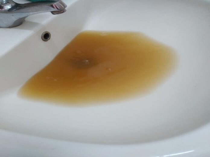 acqua sporca lavandino vdf