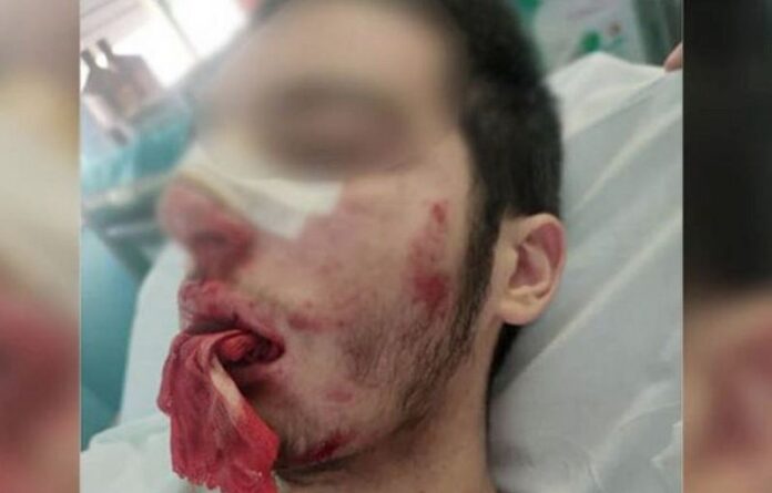 studente aggredito castrolibero