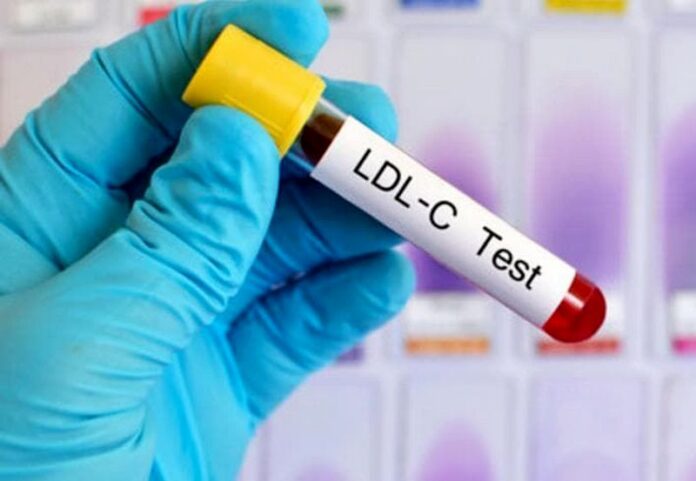 colesterolo farmaco test